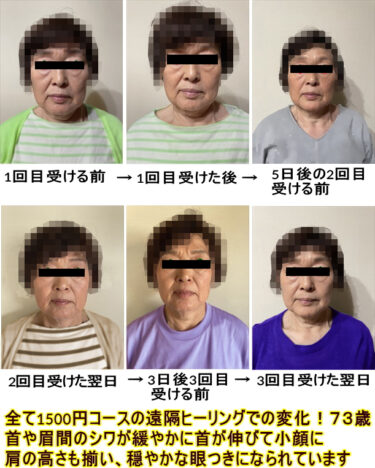 遠隔ヒーリングだけで眼付がやさしく首が伸びて姿勢よくなり足が痛くなくなった