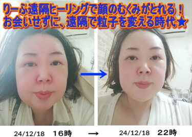 1回の遠隔ヒーリングで50代女性の顔が小さく、浮腫み取れる写真