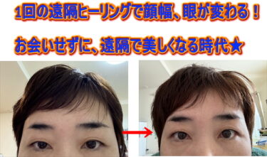 体調改善で遠隔ヒーリングを受けられたが顔、眼が変わった